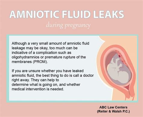 how do you know if your leaking amniotic fluid|Leaking Amniotic Fluid: Signs in 1st to 3rd Trimester